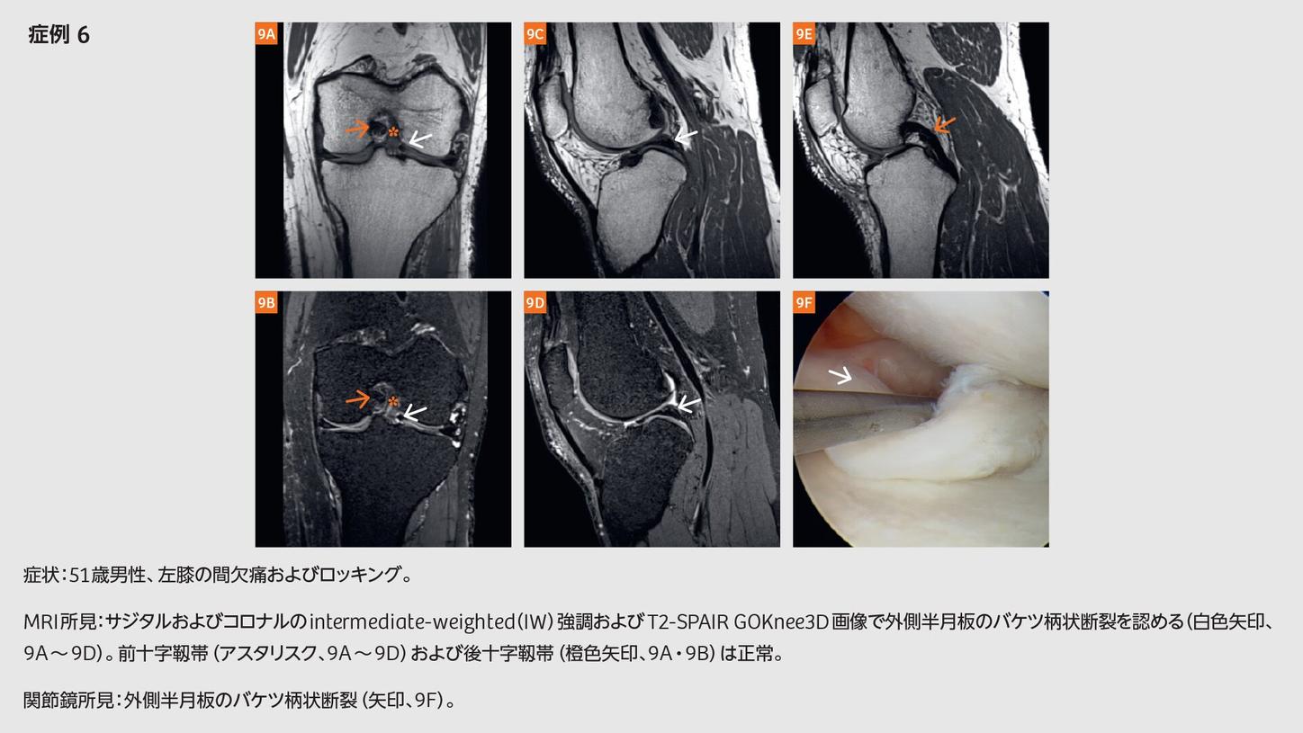 Vorlage: GOKnee3D – Fully-automated One-button-push High-resolution MRI of the GOKnee3D – Fully-automated One-button-push High-resolution MRI of the Bildidee