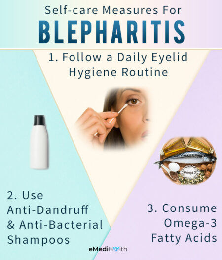 Blepharitis: Home Remedies & Self-Care Measures Foto & Idee Blepharitis: Home Remedies & Self-Care Measures